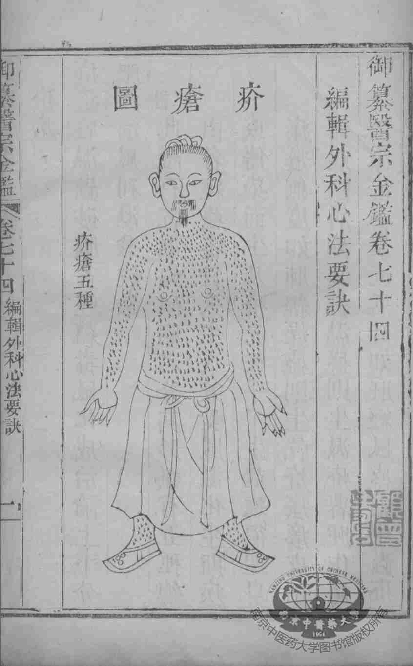 医宗金鉴  卷74-75